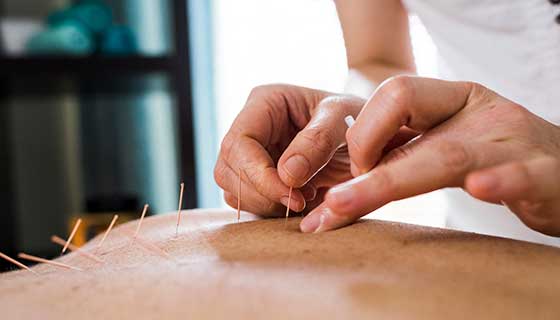 Why do doctors recommend acupuncture?