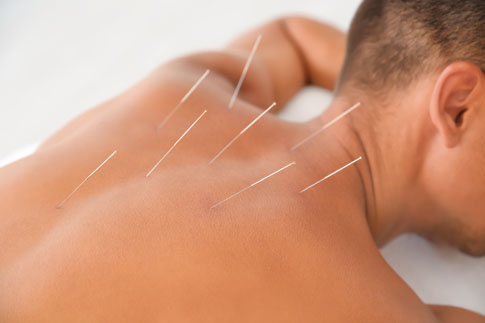 What can an acupuncturist tell by looking at your tongue?