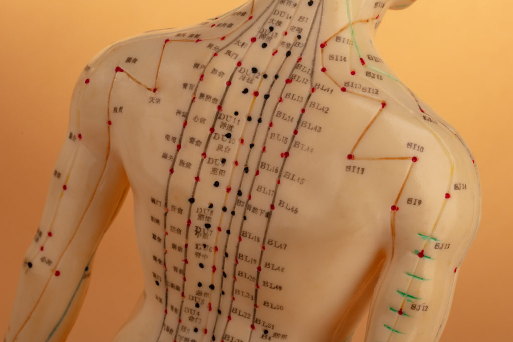 Is it normal to poop a lot after acupuncture?
