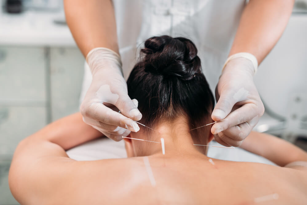 What does a white tongue mean in acupuncture?