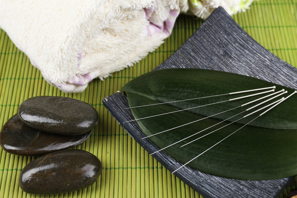 Does your body detox after acupuncture?
