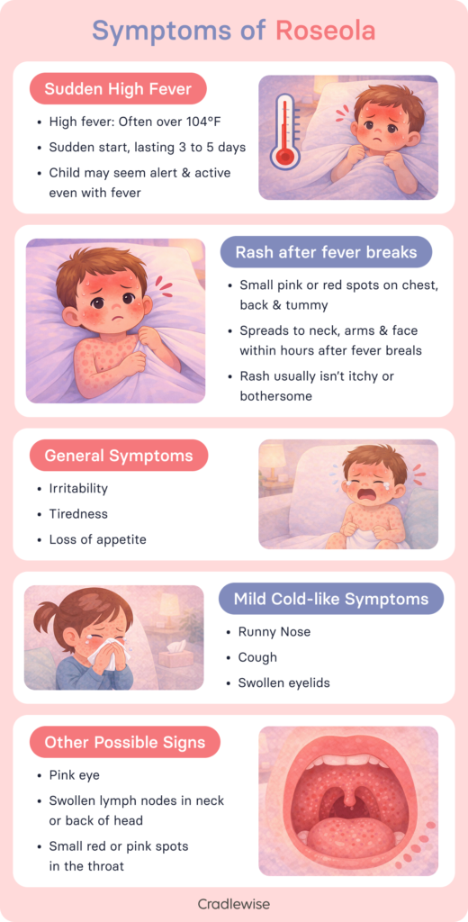 Infographic showing the symptoms of Roseola in babies