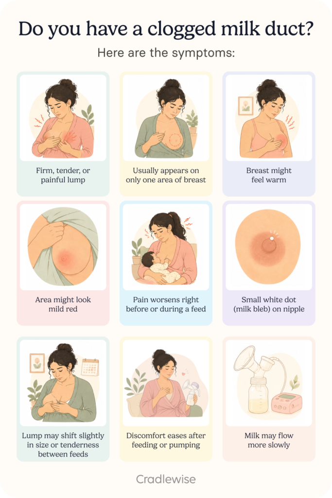 A Pinterest graphic showing the symptoms of a clogged milk duct