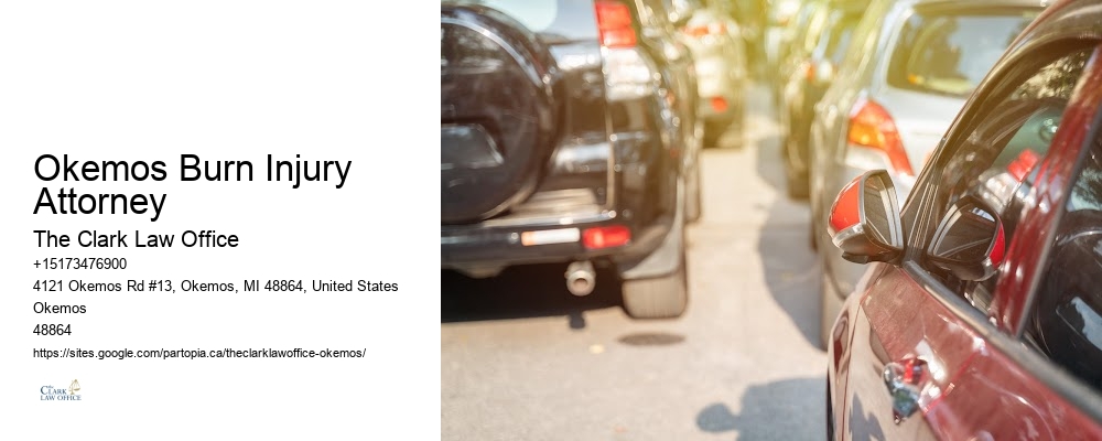 Okemos Burn Injury Attorney