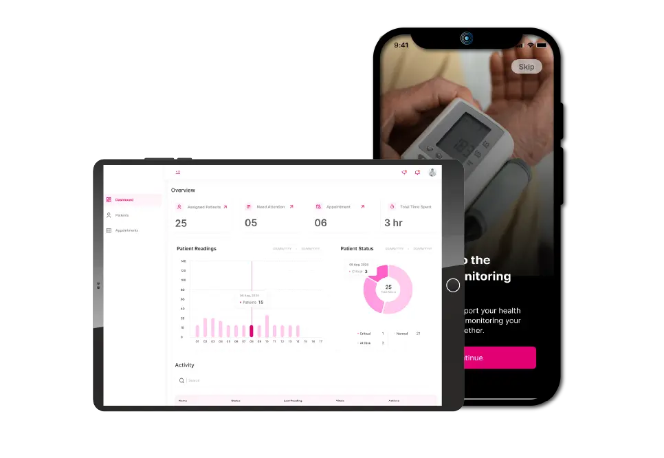 RPM case study