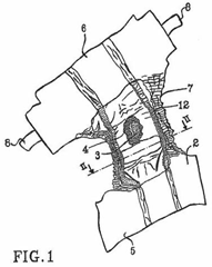 Imagen de la patente ARTiCULO ABSORBENTE QUE CONTIENE UNA COMPOSICIoN PARA EL CUIDADO DE LA PIEL.