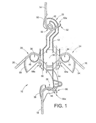 Imagen de la patente ESPACIADOR PARA CABLE AEREO CON UN BRAZO DE RETENCION PARA EL CABLE QUE TIENE UNA SECCION TRANSVERSAL EN FORMA DE CRUZ NO RECTANGULAR Y UN MIEMBRO DE SUJECION CON UNA UÑA ANGULAR.