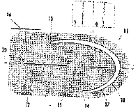 Imagen de la patente HERNIOPROTESIS CON ARCO ESTRUCTURAL SEMI-RIGIDO AUTO-DESPLEGANTE