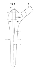 Imagen de la patente JUEGO CONSISTIENDO DE PROTESIS DE CADERA COMPRENDIENDO VASTAGO PARA INSERCION EN FEMUR Y DE HERRAMIENTA.