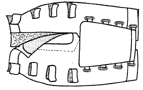 Imagen de la patente MEJORAS A MONTAJES OPRESIVOS DE MUSCULOS ABDOMINALES PARA USO POSTPARTO DE FACIL COLOCACION