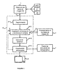 Imagen de la patente PROCEDIMIENTO Y DISPOSITIVO PARA LA ASISTENCIA VISUAL DEL USO ELECTROFISIOLOGICO DE UN CATETER EN EL CORAZON.