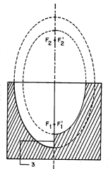 Imagen de la patente REFLECTORES ASIMETRICOS PARA DESFASAR Y CONCENTRAR ONDAS DE CHOQUE EN LITOTRIPTORES EXTRACORPORALES