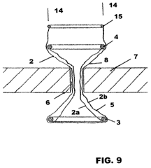 Imagen de la patente UN DISPOSITIVO RETRACTOR DE HERIDA.