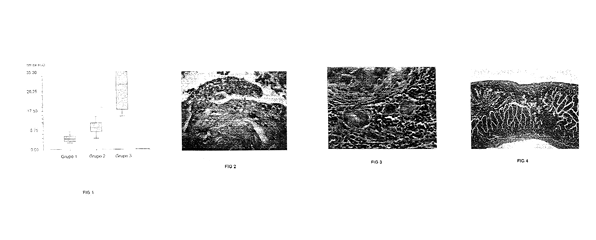 Imagen de la patente UN NUEVO ADHESIVO BIOLOGICO BIODEGRADABLE, NO TOXICO, PARA USO EN CIRUGIA ABDOMINAL.
