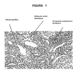 Imagen de la patente USO DE INHIBIDORES DE VASOPEPTIDASA EN EL TRATAMIENTO DE NEFROPATIA.