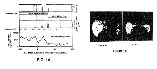 Imagen de la patente USO DE LEPTINA PARA TRATAR LIPOATROFIA HUMANA Y MeTODO PARA DETERMINAR LA PREDISPOSICIoN A DICHO TRATAMIENTO.