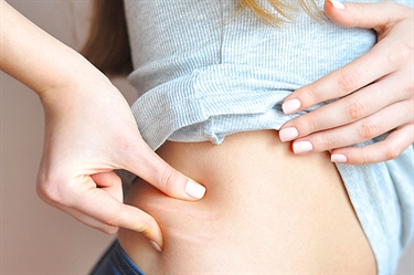 Post Partum Stretch Marks