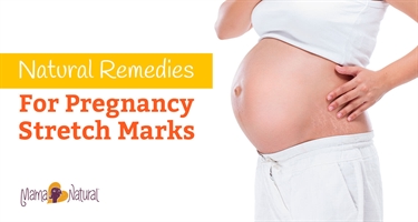 How To Remove Stretch Marks On Legs