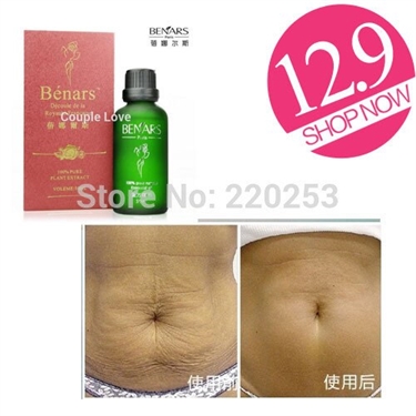 Forum Pregnancy Laser Stretch Marks