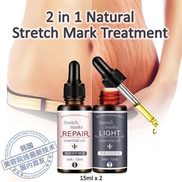 How To Reduce Appearance Of Stretch Marks During Pregnancy