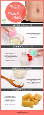 Remove Stretch Marks On Buttocks