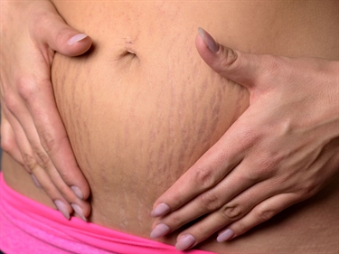 How Long Does It Take To Heal After Delivery