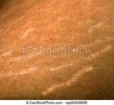 Best Pregnant Belly Cream