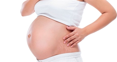 How Celebrities Prevent Pregnancy Stretch Marks