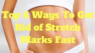 Stretch Marks Under Butt