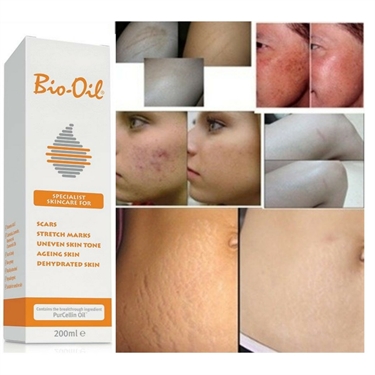 Remove Stretch Mark Cream