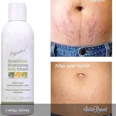 How Long Do Scratch Marks Last