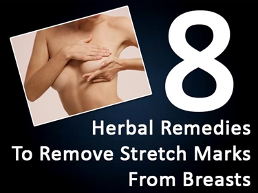 How To Prevent Stretch Marks From Lifting