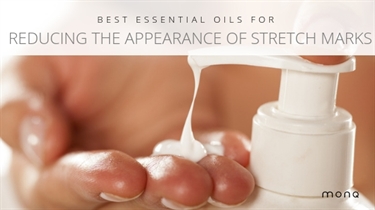 Living With Stretch Marks