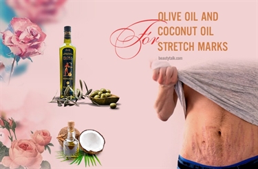 New Treatments For Stretch Marks