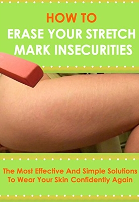 How To Not Get Stretch Marks When Working Out
