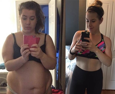 Getting Stretch Marks From Pregnancy