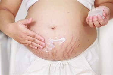 Stretch Marks On The Breast During Pregnancy