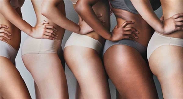 How Do You Know If You Have Stretch Marks