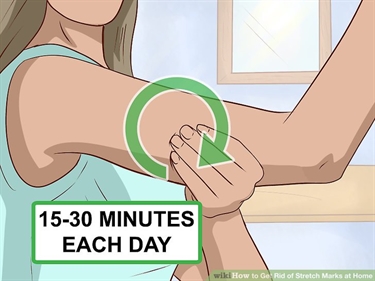Best Thing To Prevent Pregnancy Stretch Marks