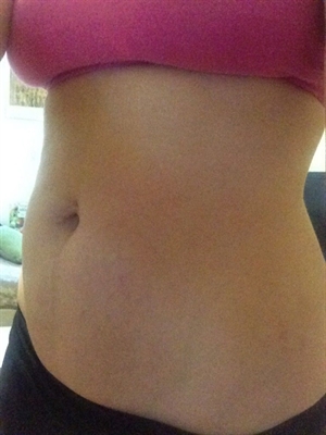 How To Keep From Getting Pregnancy Stretch Marks