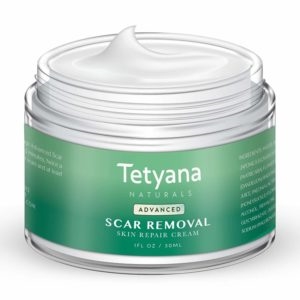 Is It Possible To Remove Stretch Marks