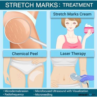 C Stretch