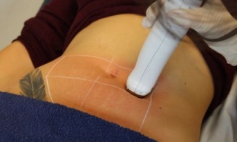 Medical Term For Scratch Marks