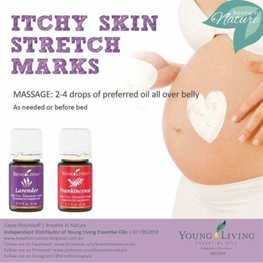 What Do Stretch Marks Look Like When They First Start