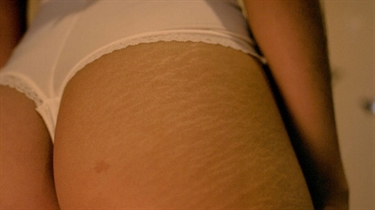 How To Get Rid Of Baby Fat After C Section