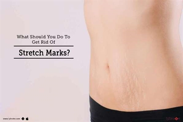 Stretch Mark Legs