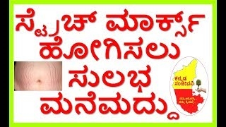 Quickest Way To Remove Stretch Marks