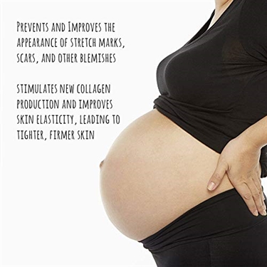 How I Prevented Stretch Marks During Pregnancy