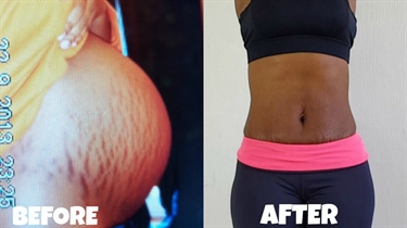 Pregnancy Bellies At 15 Weeks