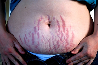 How To Form Pregnant